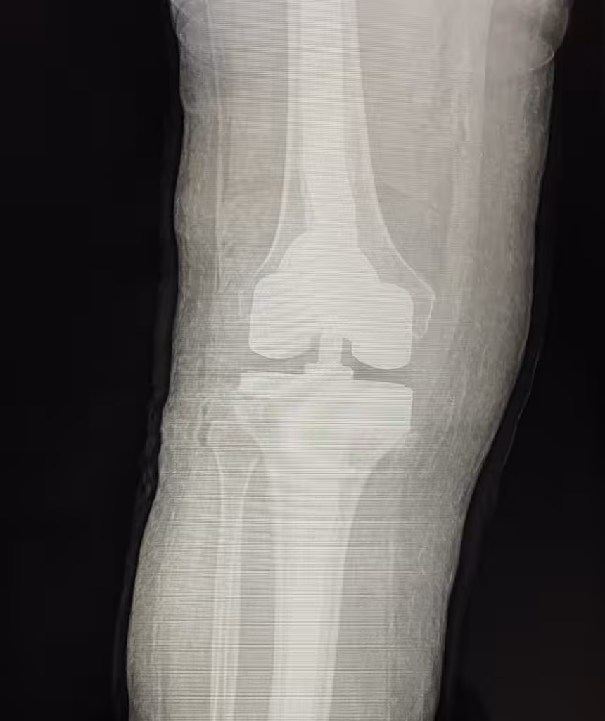 Case Image