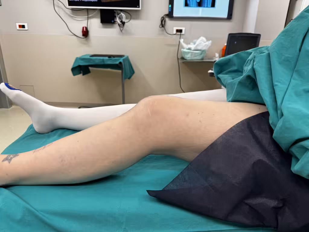 Case Image