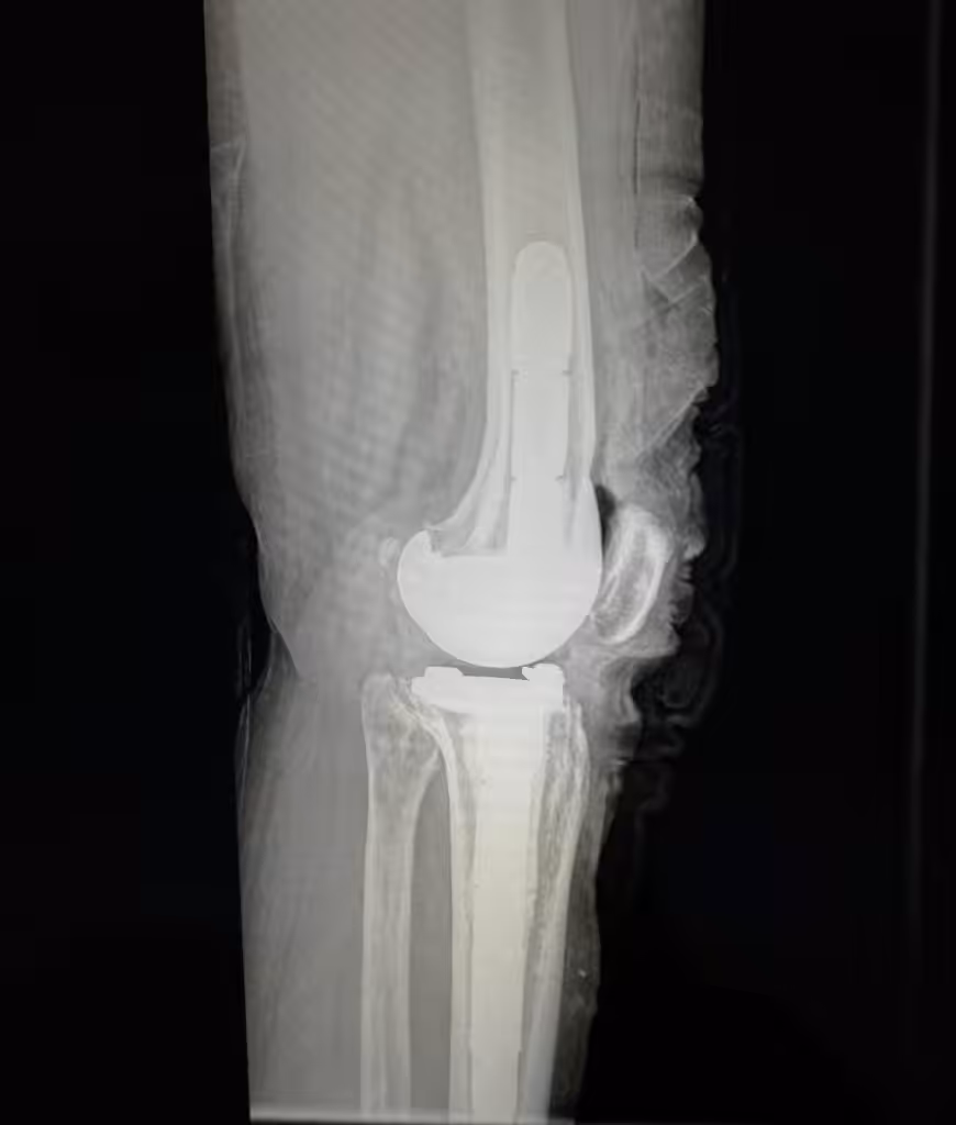 Case Image