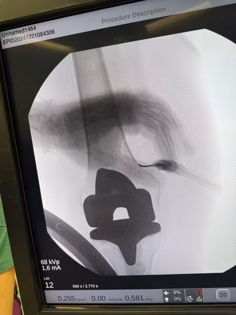 Case Image