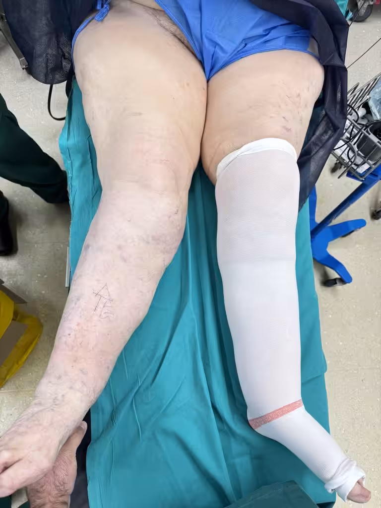 Case Image