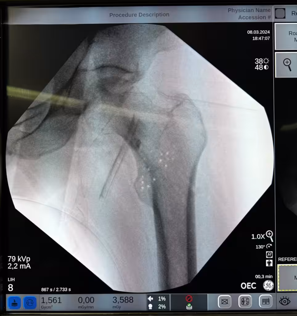 Case Image