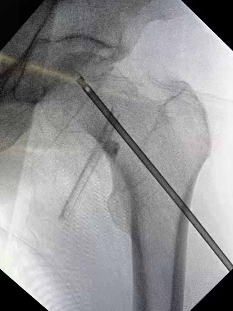 Case Image