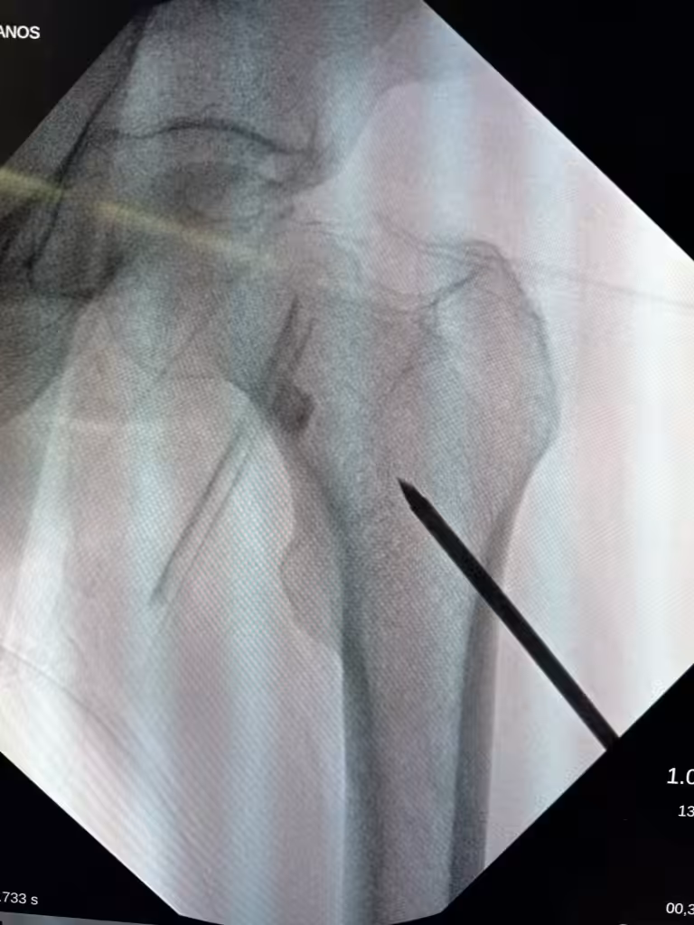 Case Image