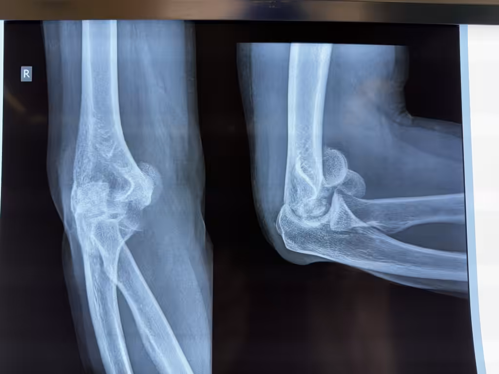Case Image