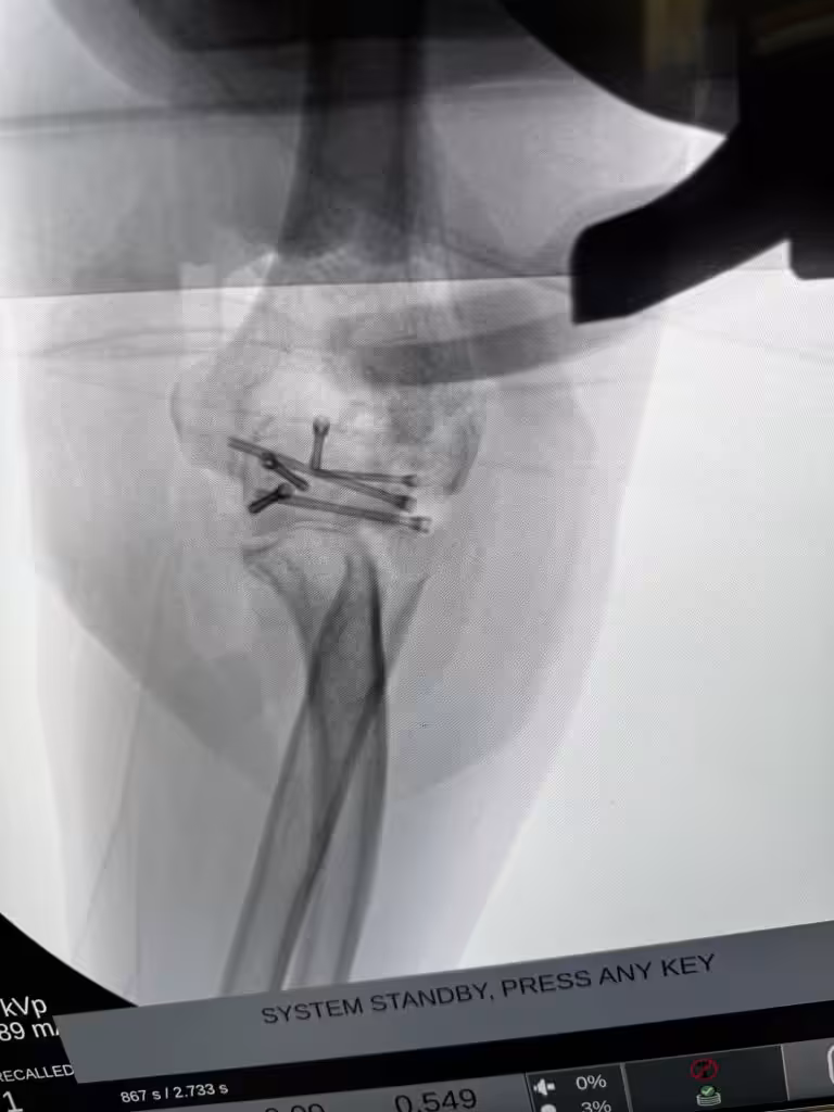 Case Image