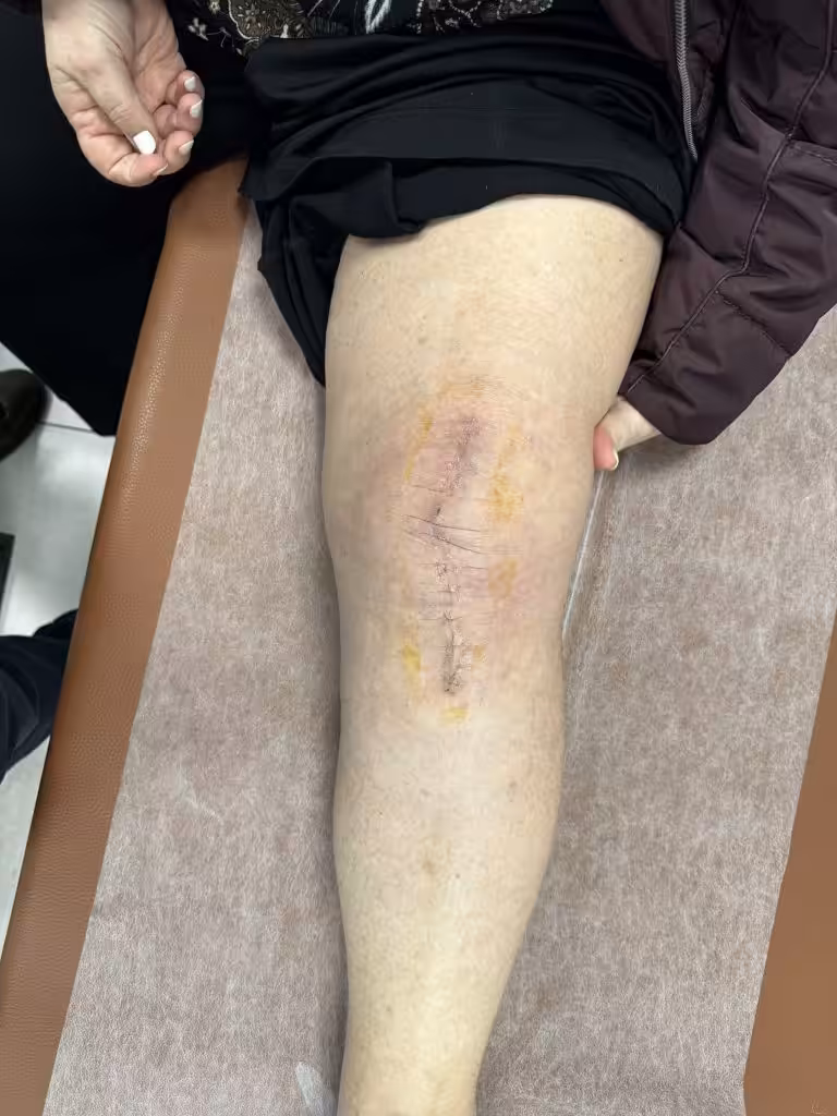 Case Image