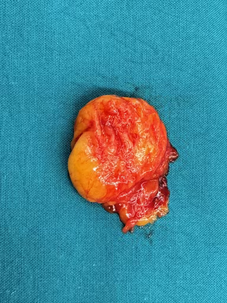 Case Image