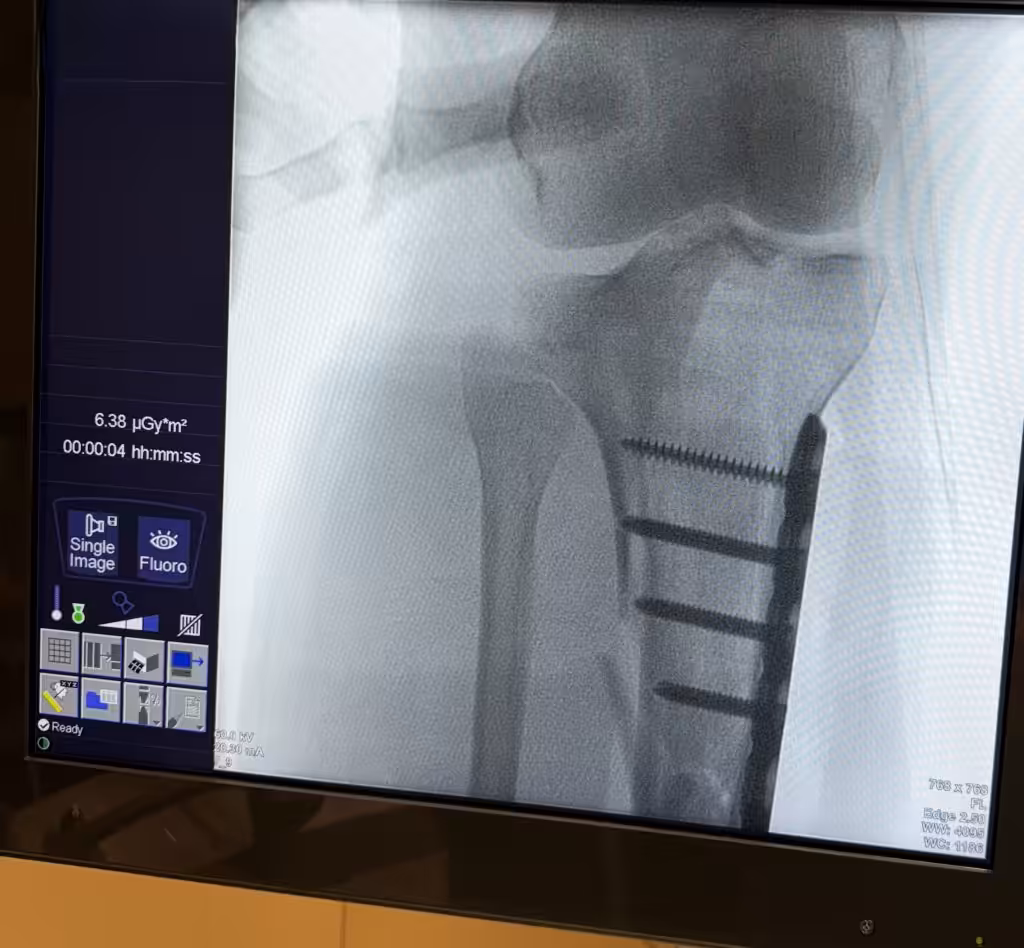 Case Image