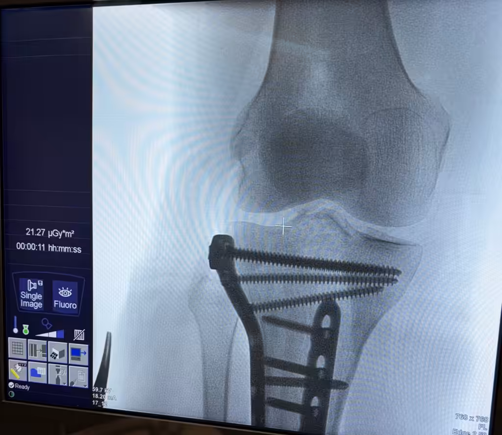 Case Image