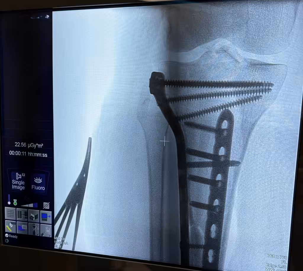Case Image