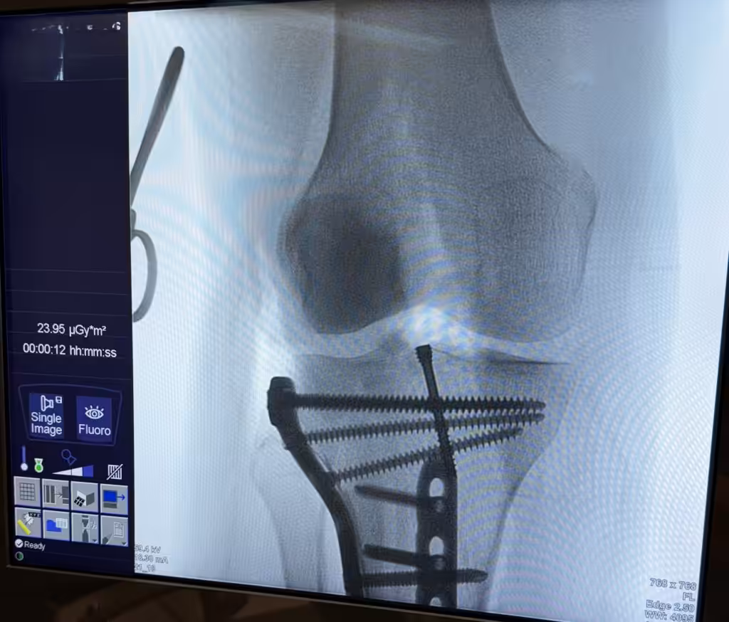 Case Image
