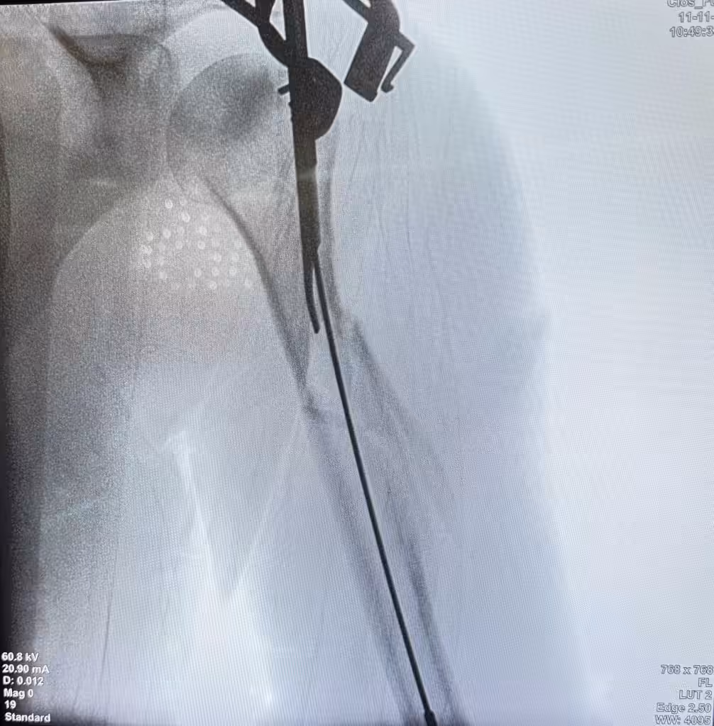 Case Image