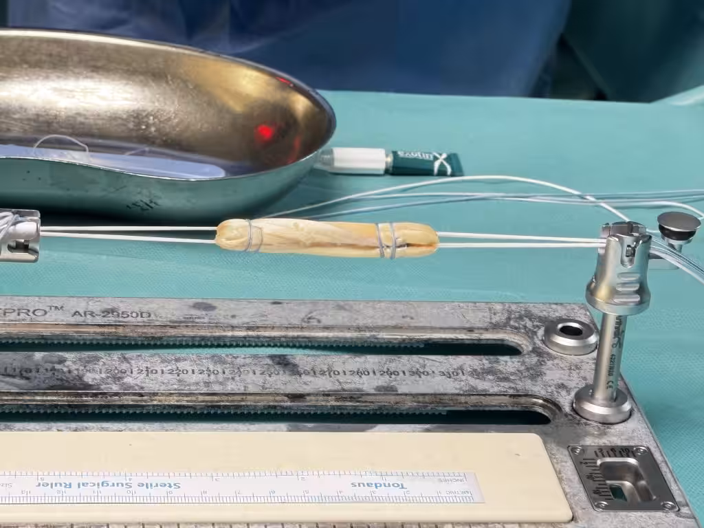 Case Image