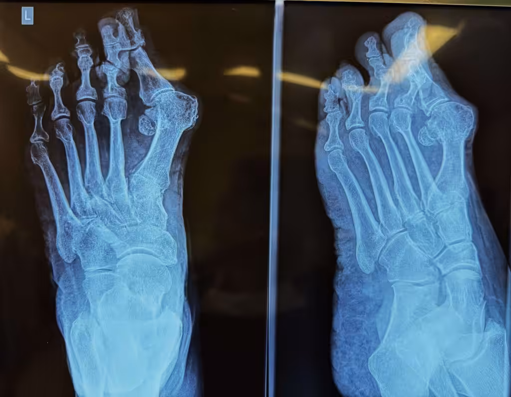 Case Image