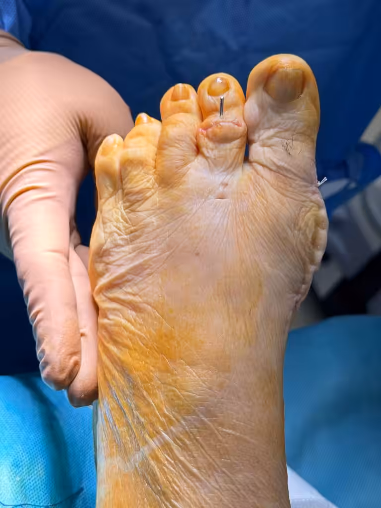 Case Image