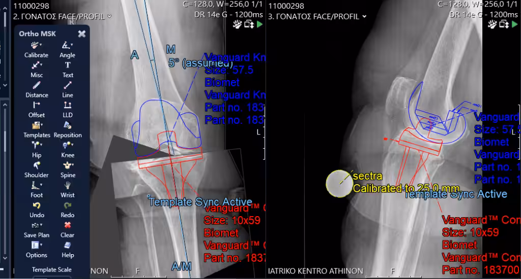 Case Image