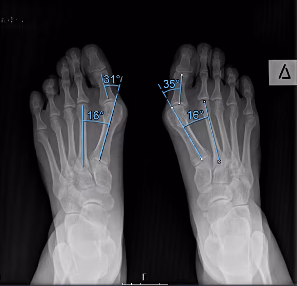 Case Image