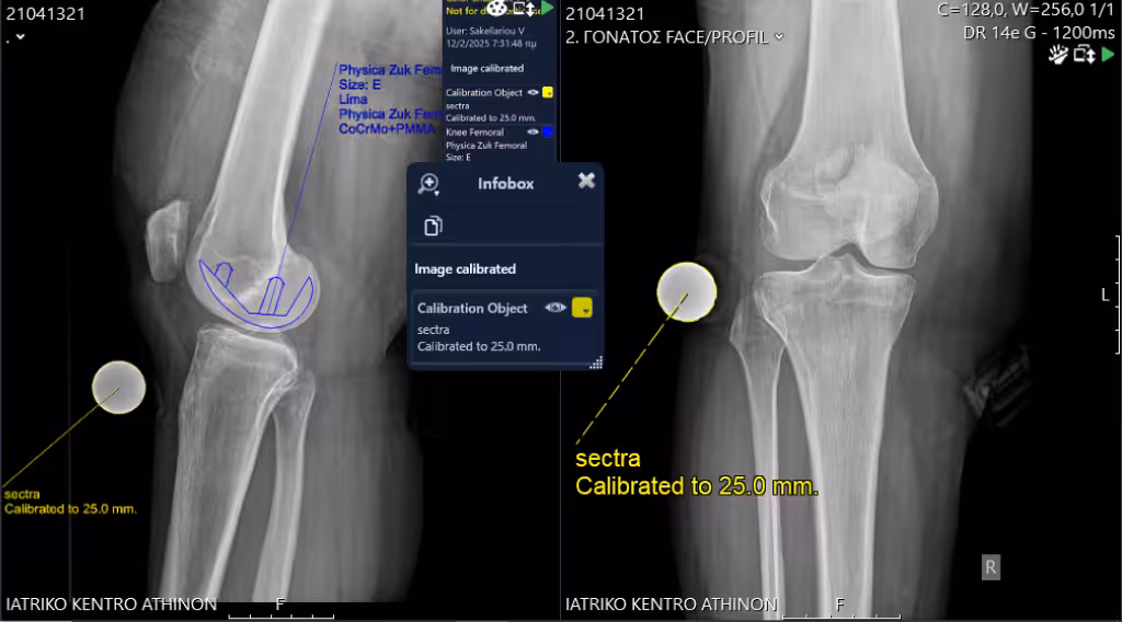 Case Image