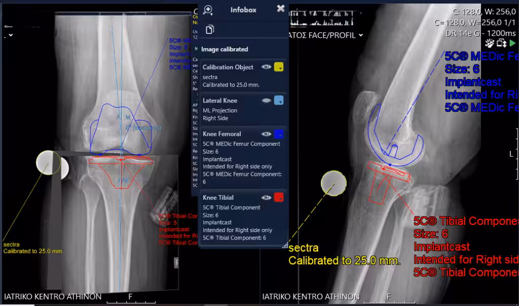Case Image