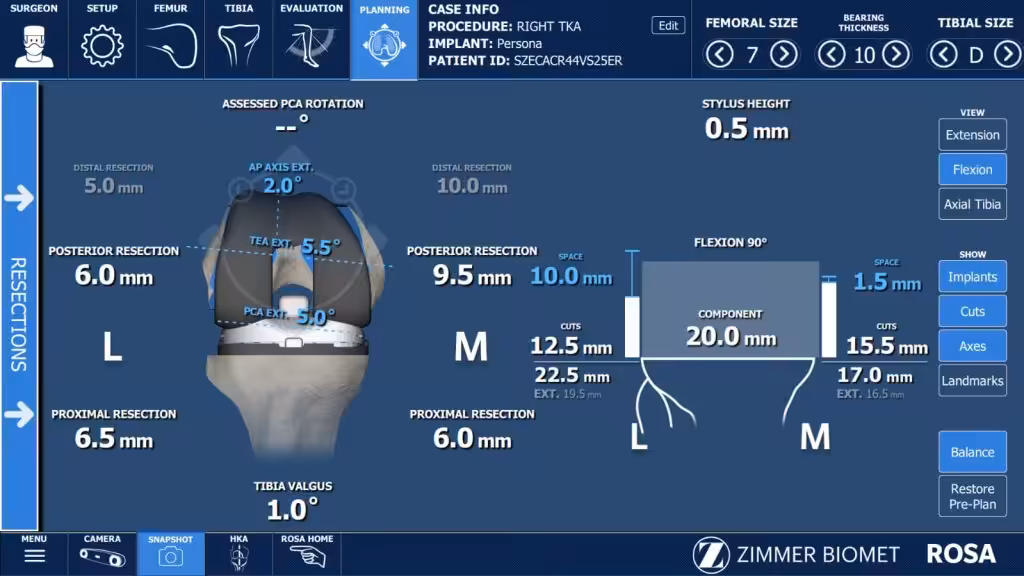 Case Image
