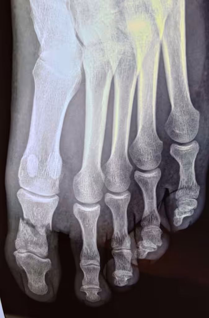 Case Image
