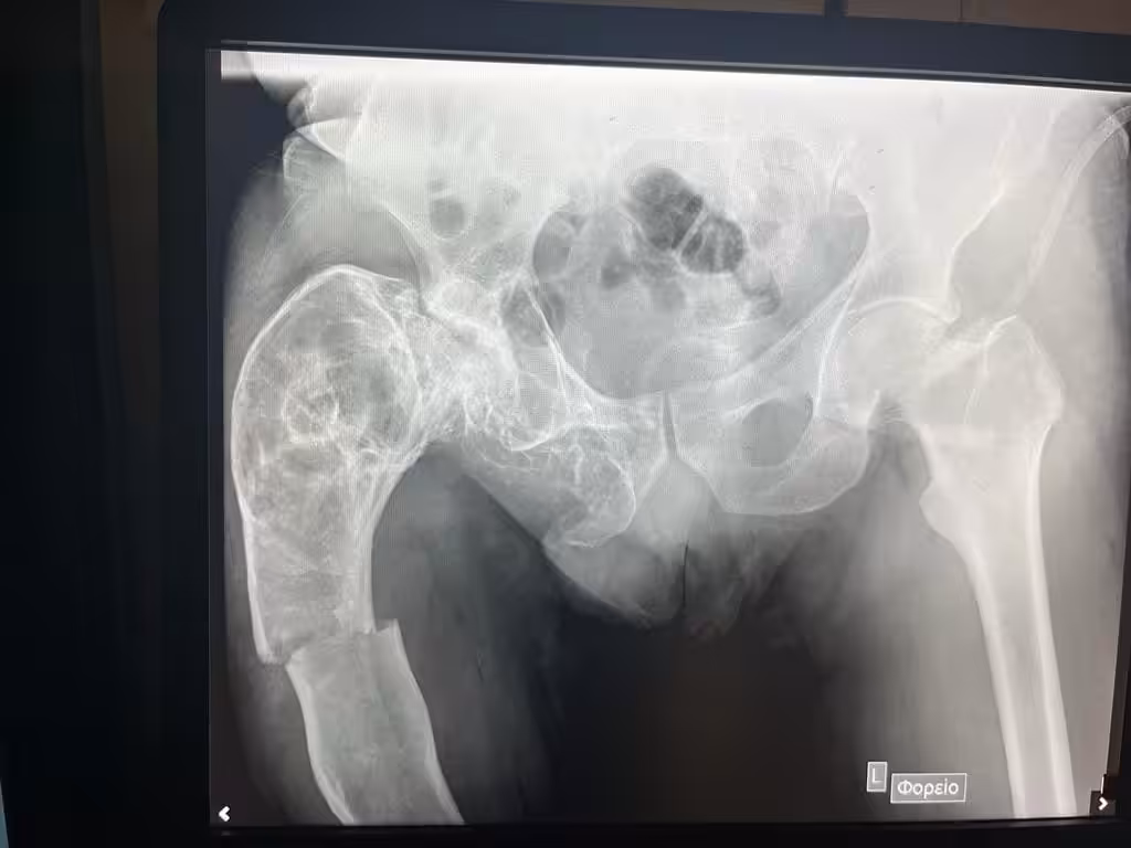Case Image